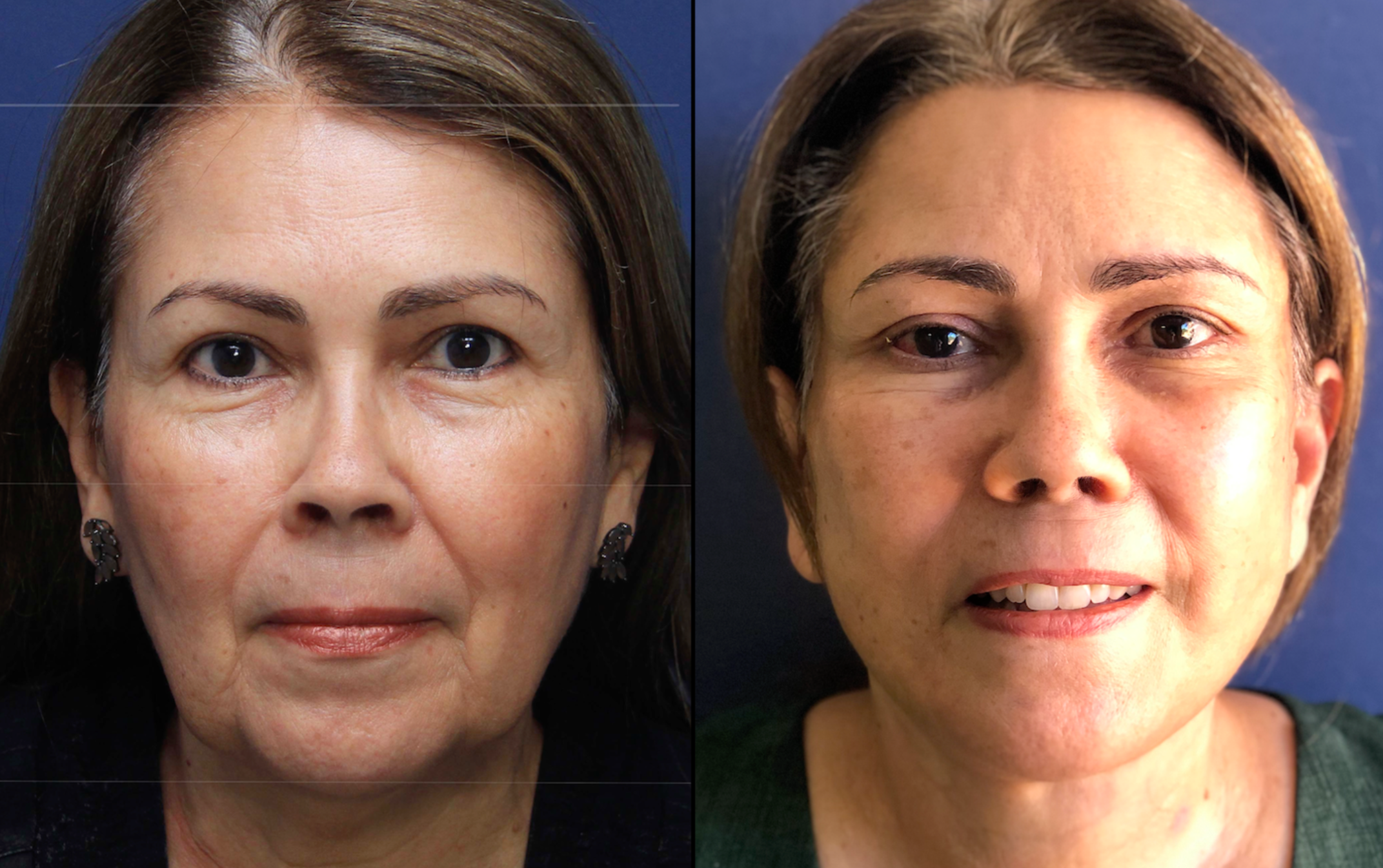 Captura de Tela 2025-11-29 às 16.17.08 1